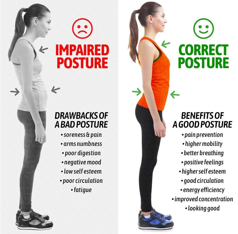 Posture Corrector